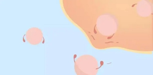 移植囊胚第五天胸部不胀变软正不正常 移植囊胚胸不胀是怎么回事